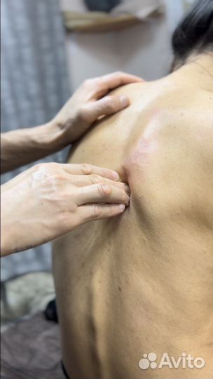 Миофасциальный лечебный массаж-Миопрессура