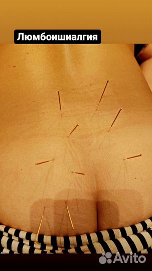 Мануальный массаж (остеопатия)