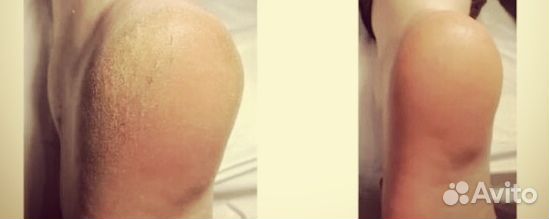 Маникюр педикюр на дому