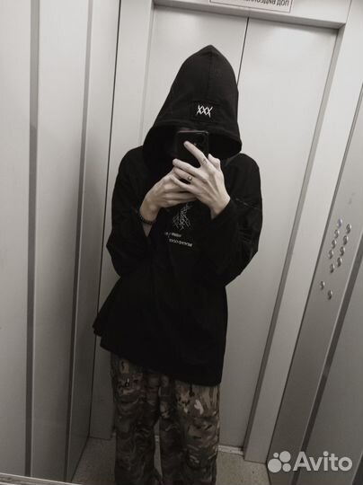 Conjunctiva untilted oct9