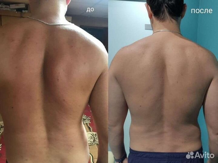 Персональный тренер, реабилитолог, кинезиолог