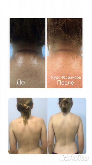 Массаж спины, тела избавление от боли и спазмов