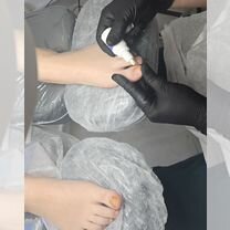 Подолог,вросший ноготь,грибок,мозоль, Мурино