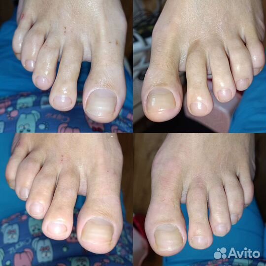 Подолог с медицинским образованием Девяткино