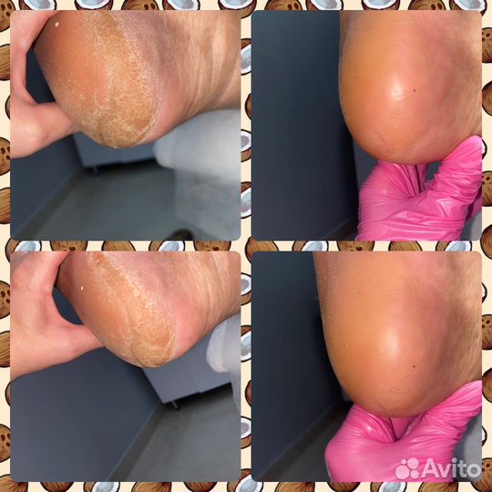 Smart педикюр